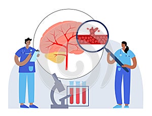 Brain stroke hemorrhagic