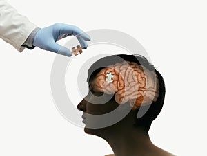 Brain treatment concept