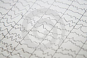 Brain wave on electroencephalogram, EEG chart, EEG of children`s brain.