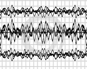 Brain waves