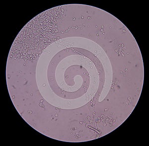 Branching budding yeast cells