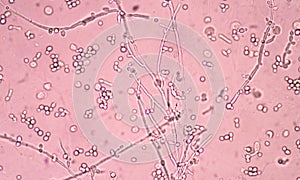 Branching budding yeast cells