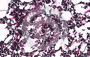 Branching budding yeast cells with pseudohyphae in urine gram st