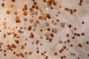 Bread mold fungi under microscope for education photo