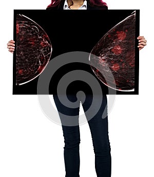 breast cancer awareness  against woman for fight against breast cancer  showing X-ray Digital Mammogram  isolated on white