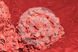 Breast cancer cells is growing closeup 3d illustration