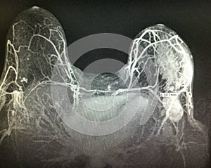 Seni cancro irregolare questione visita medica 