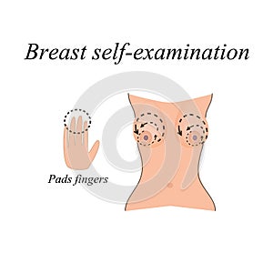 Breast self-examination. The fight against breast
