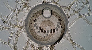Bright field light microscope image of Sclerotinia sclerotiorum ascocarp perithecia at 1000x magnification