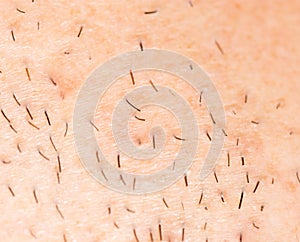 Bristles on the skin. close-up