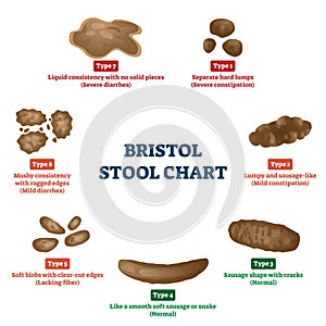 Bristol stool chart tool for faeces type classification vector illustration