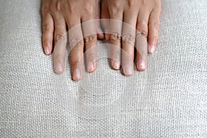 Brittle damaged nails after using shellac or gel-lacquer photo