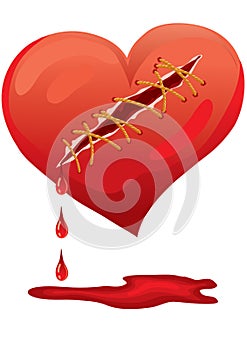 Broken heart sewn with threads, isolated object on a white background, vector illustration