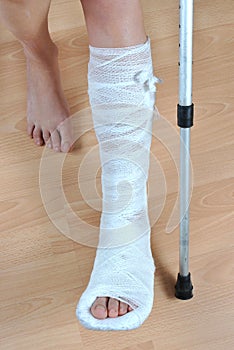 Broken leg