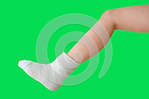 Broken leg on a green background in a plaster cast. Foot bone bruise or fracture. Insurance claim scenario. Injury, trauma,