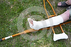 broken leg, halinastop fracture, male leg bent, white cast