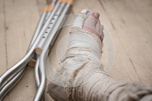 Broken leg in plaster on a shabby wooden floor