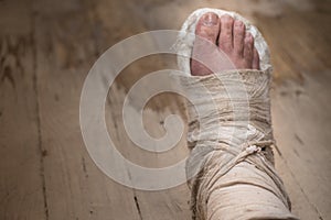 Broken leg in plaster on a shabby wooden floor