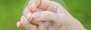 Broken nail on a woman`s hand with a manicure on a green background BANNER, LONG FORMAT