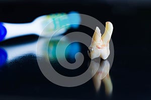 Broken tooth after extraction with toothbrush in the background photo