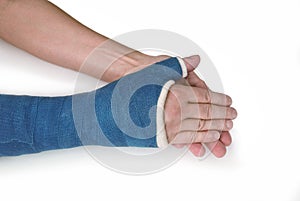 Broken wrist, arm with a blue fiberglass cast photo