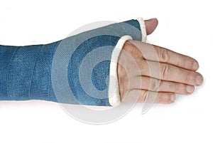 Broken wrist, arm with a blue fiberglass cast