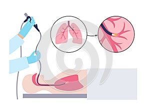 Bronchoscopy procedure concept