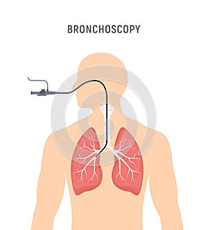 Bronchoscopy respiratory system emphysema endoscopy human lung examination. Bronchoscopy icon