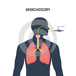 Bronchoscopy respiratory system emphysema endoscopy human lung examination. Bronchoscopy icon photo