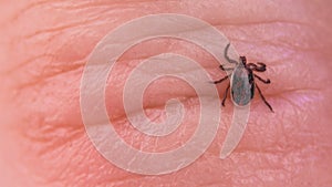 Brown dog tick parasite. Skin close-up. Rhipicephalus sanguineus. Ixodida