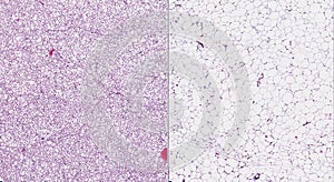 Brown (left) and white (right) fat