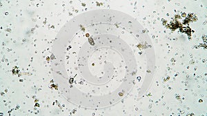 Brown oval infusoria Coleps is trying to eat the yellow round one under the microscope