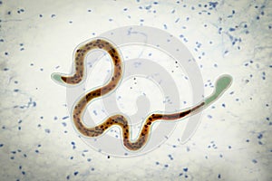 Brugia malayi, a roundworm nematode