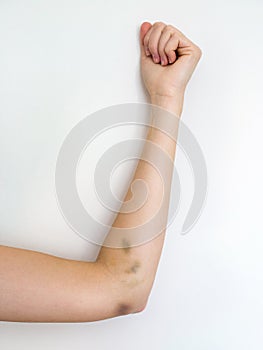 Bruised womans arm on white background, domestic violence