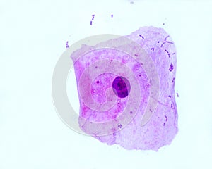 Squamous epithelial cell photo