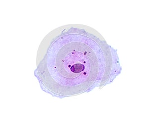 Buccal smear. Squamous epithelial cells photo
