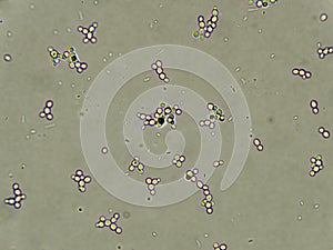 Budding yeast cells photo