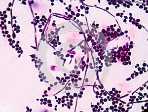 Budding yeast cells with pseudohyphae