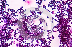 Budding yeast cells with pseudohyphae