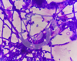 Budding yeast cells with pseudohyphae