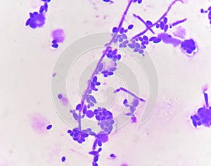 Budding yeast cells with pseudohyphae
