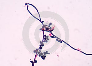 Budding yeast cells with pseudohyphae