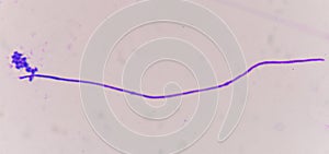 Budding yeast with pseudohyphae