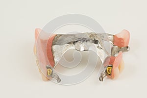Bugel remove dentures with attachments