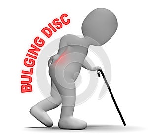 Bulging Disc Shows Chiropractor Vertebral And Backbone 3d Rendering