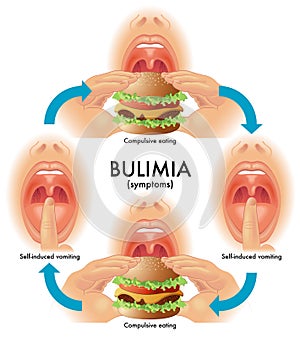Bulimia photo