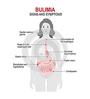 Bulimia. Signs and symptoms photo