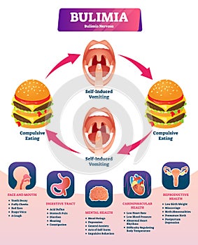 Bulimia vector illustration. Labeled self induced vomiting diagnosis scheme photo