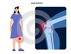 Bursitis inflammation concept