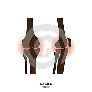 Bursitis and Knee Joint Icon